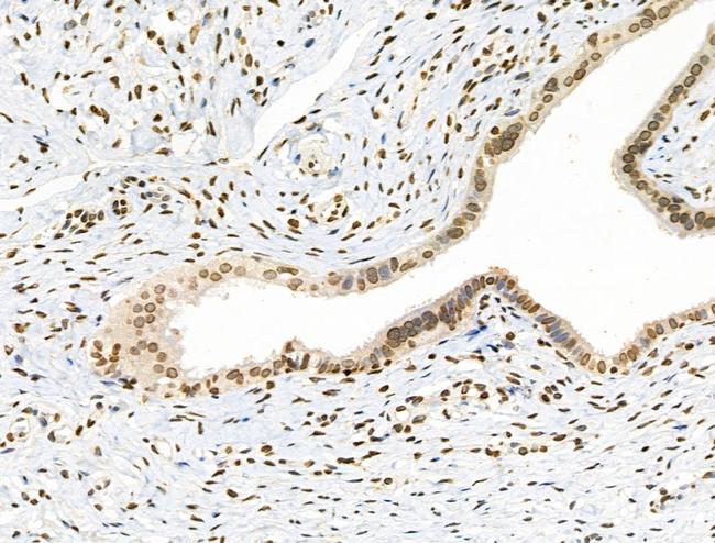 Phospho-NBS1 (Ser278) Antibody in Immunohistochemistry (Paraffin) (IHC (P))