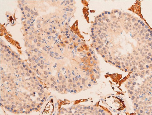 Acetyl-p53 (Lys319) Antibody in Immunohistochemistry (Paraffin) (IHC (P))