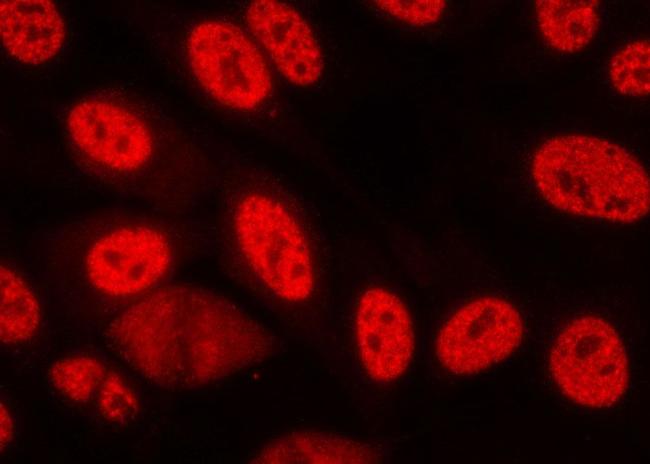 Phospho-Chk1 (Ser280) Antibody in Immunocytochemistry (ICC/IF)