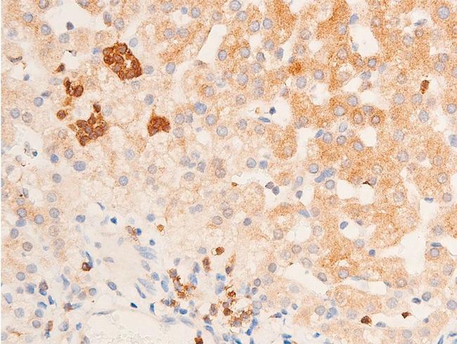 Phospho-Chk1 (Ser317) Antibody in Immunohistochemistry (Paraffin) (IHC (P))