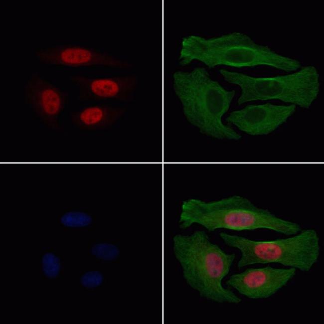 Phospho-HDAC3 (Ser424) Antibody in Immunocytochemistry (ICC/IF)