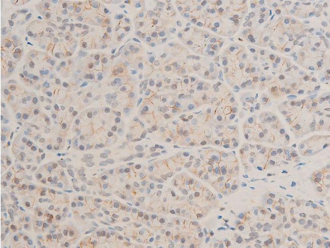 Phospho-TAK1 (Thr187) Antibody in Immunohistochemistry (Paraffin) (IHC (P))