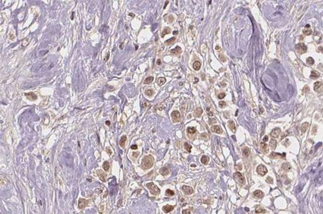 Phospho-Estrogen Receptor alpha (Ser167) Antibody in Immunohistochemistry (Paraffin) (IHC (P))