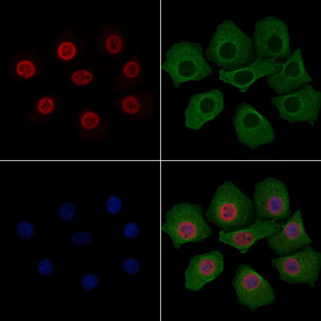 Phospho-Estrogen Receptor alpha (Ser106) Antibody in Immunocytochemistry (ICC/IF)