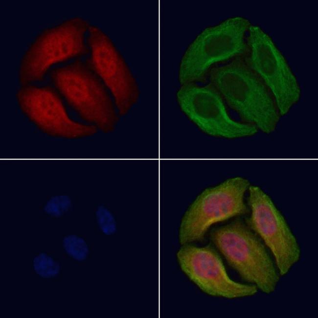 Phospho-p53 (Ser366) Antibody in Immunocytochemistry (ICC/IF)