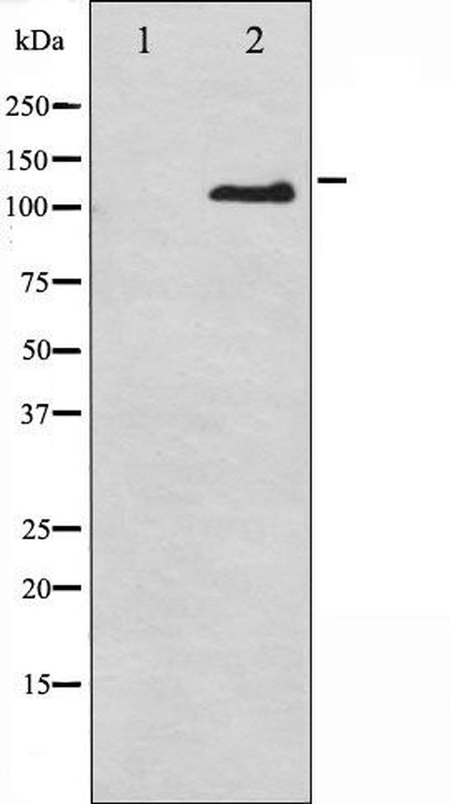 Phospho-CD61 (Tyr785) Antibody in Western Blot (WB)