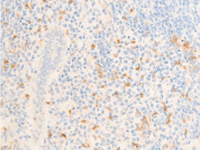 Phospho-ICAM-1 (Tyr512) Antibody in Immunohistochemistry (Paraffin) (IHC (P))