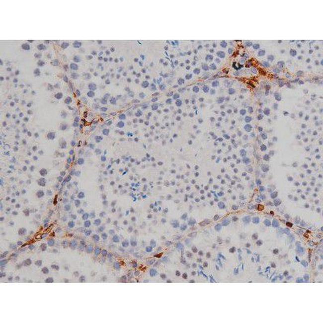 Phospho-Lyn (Tyr508) Antibody in Immunohistochemistry (Paraffin) (IHC (P))