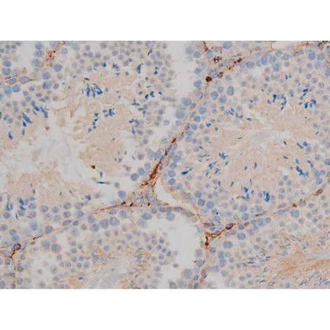 Phospho-BCL-2 (Ser70) Antibody in Immunohistochemistry (Paraffin) (IHC (P))