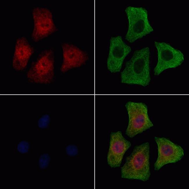 Phospho-FGFR1 (Tyr154) Antibody in Immunocytochemistry (ICC/IF)