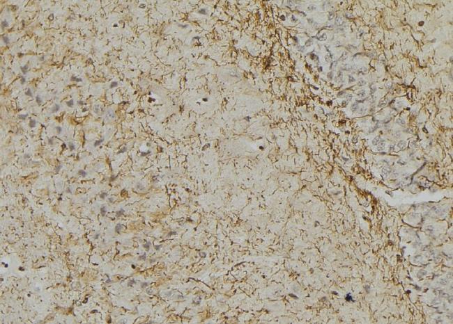 Phospho-GFAP (Ser38) Antibody in Immunohistochemistry (Paraffin) (IHC (P))