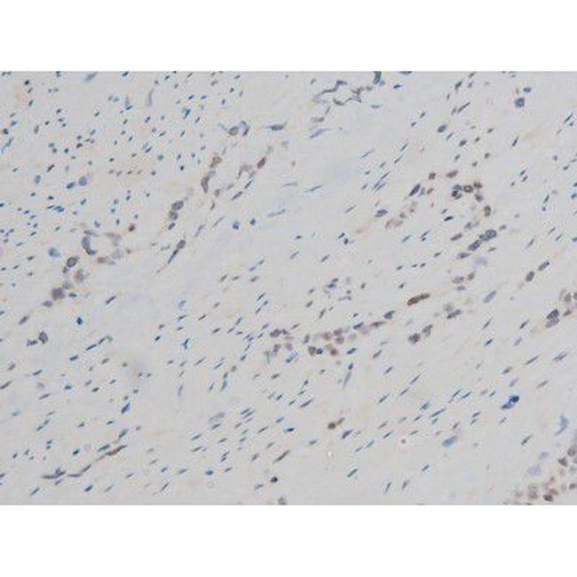 Phospho-GATA1 (Ser142) Antibody in Immunohistochemistry (Paraffin) (IHC (P))