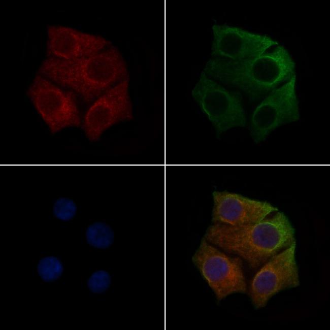 Phospho-VEGF Receptor 1 (Tyr1213) Antibody in Immunocytochemistry (ICC/IF)