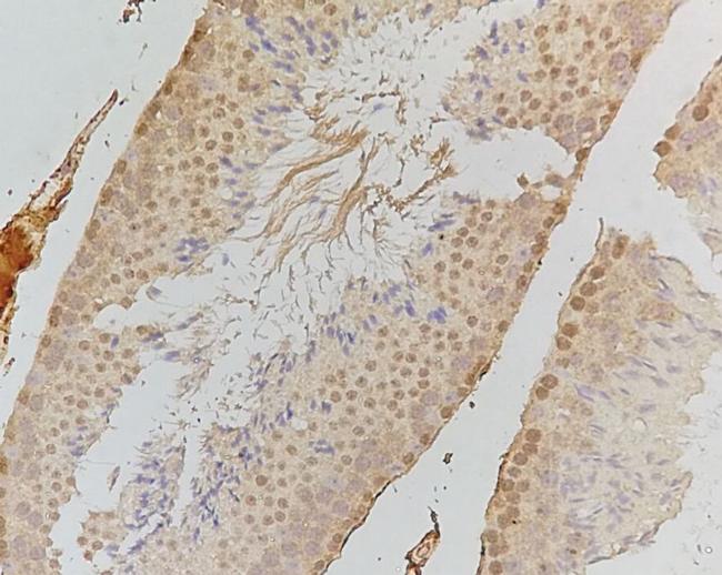 Phospho-PKR (Thr446) Antibody in Immunohistochemistry (Paraffin) (IHC (P))