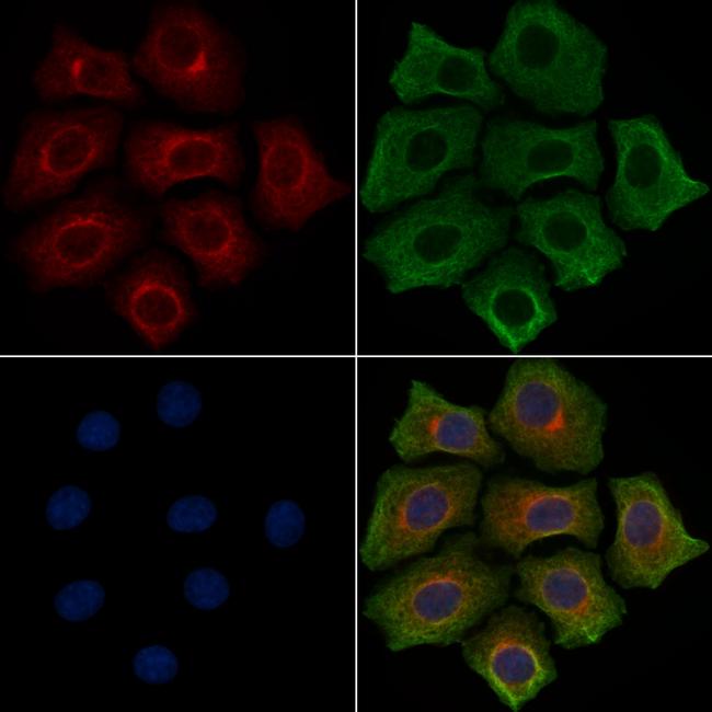 Phospho-NFkB p105 (Ser893) Antibody in Immunocytochemistry (ICC/IF)