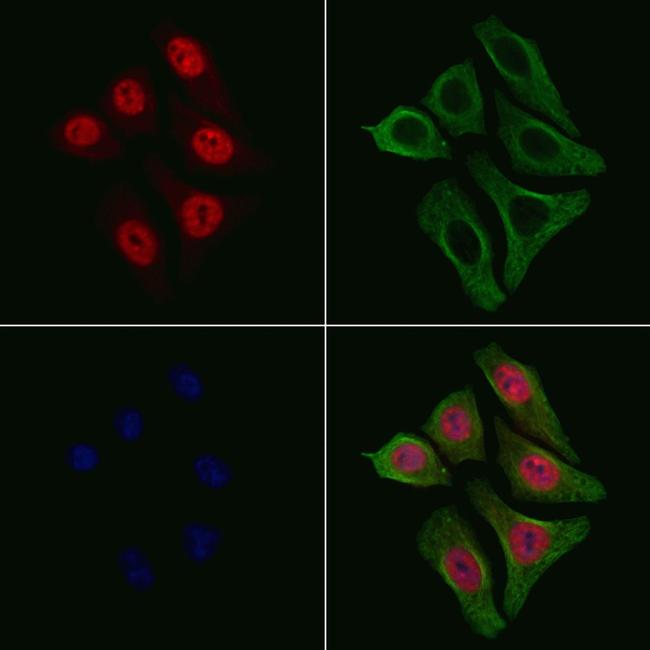 Phospho-NFkB p105/p50 (Ser907) Antibody in Immunocytochemistry (ICC/IF)