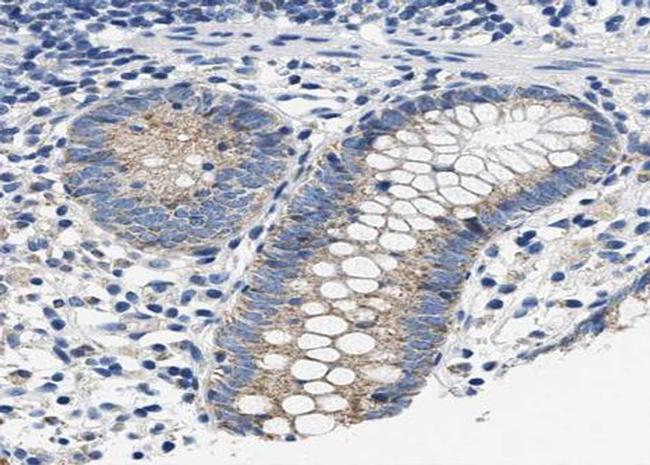 Phospho-iNOS (Tyr151) Antibody in Immunohistochemistry (Paraffin) (IHC (P))