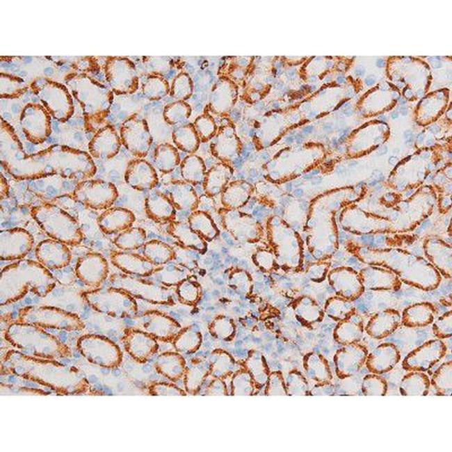 Phospho-JNK1/JNK2/JNK3 (Thr183) Antibody in Immunohistochemistry (Paraffin) (IHC (P))