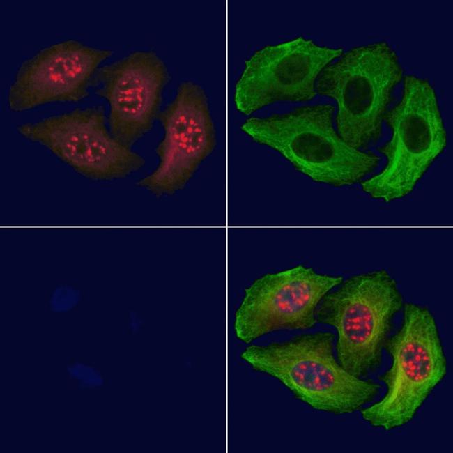 Phospho-MEF2A (Thr319) Antibody in Immunocytochemistry (ICC/IF)