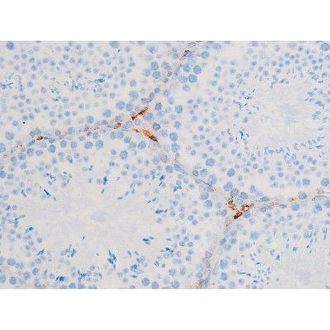 Phospho-PKC theta (Ser676) Antibody in Immunohistochemistry (Paraffin) (IHC (P))