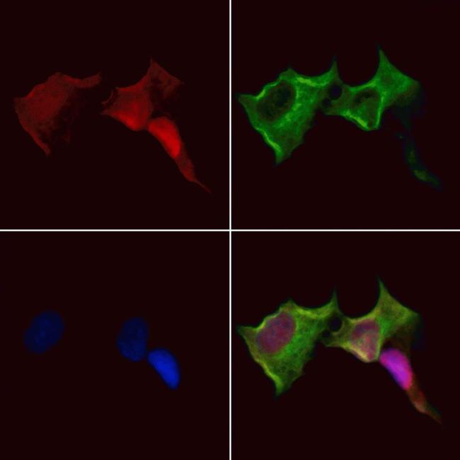 TWIST2 Antibody in Immunocytochemistry (ICC/IF)