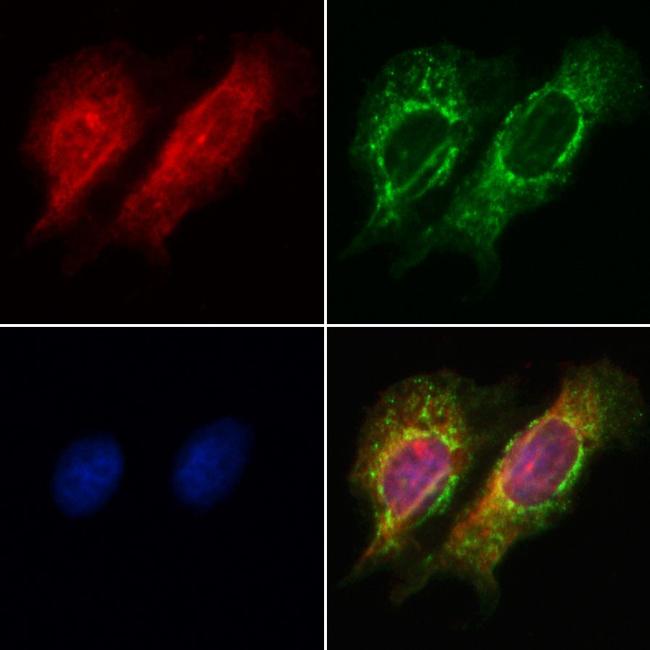 PIK3CA Antibody in Immunocytochemistry (ICC/IF)