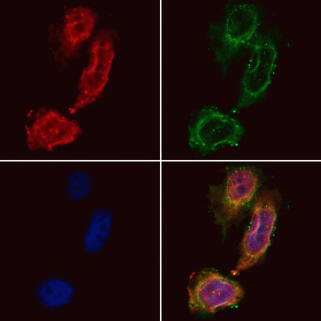 SMAD5 Antibody in Immunocytochemistry (ICC/IF)