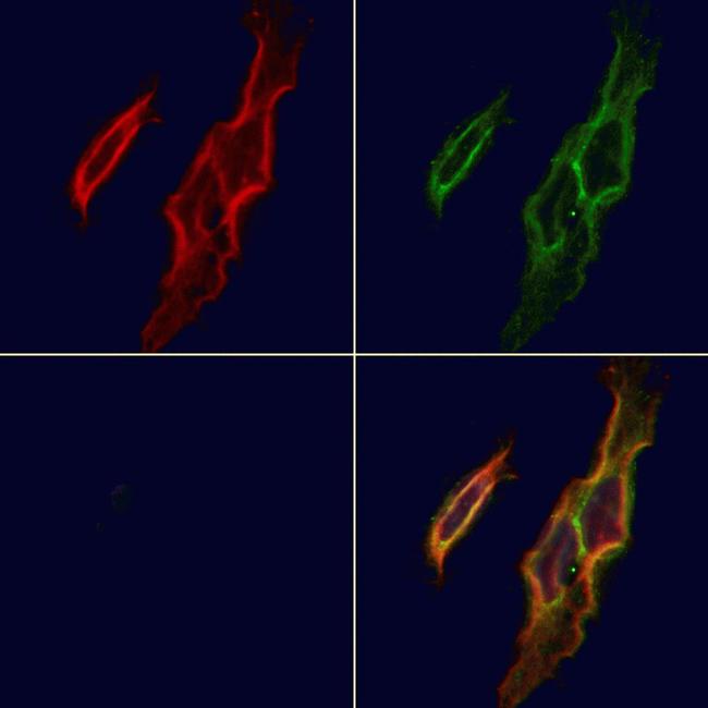 CD103 Antibody in Immunocytochemistry (ICC/IF)