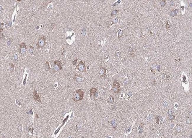 BMP-6 Antibody in Immunohistochemistry (Paraffin) (IHC (P))