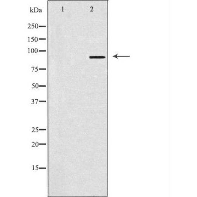 SOX6 Antibody in Western Blot (WB)