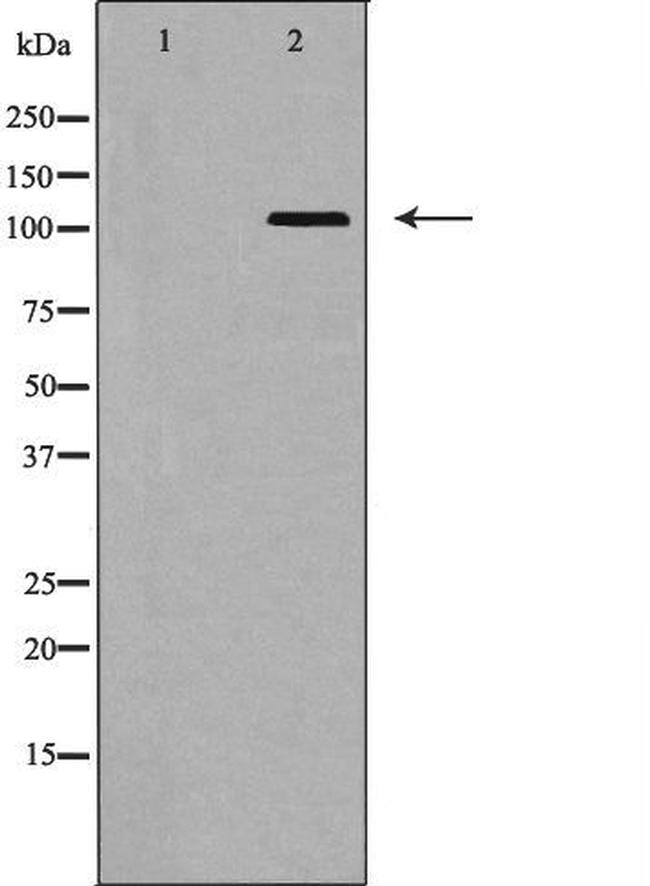 EphA5 Antibody in Western Blot (WB)