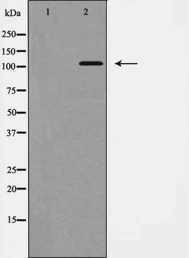 EphB1 Antibody in Western Blot (WB)