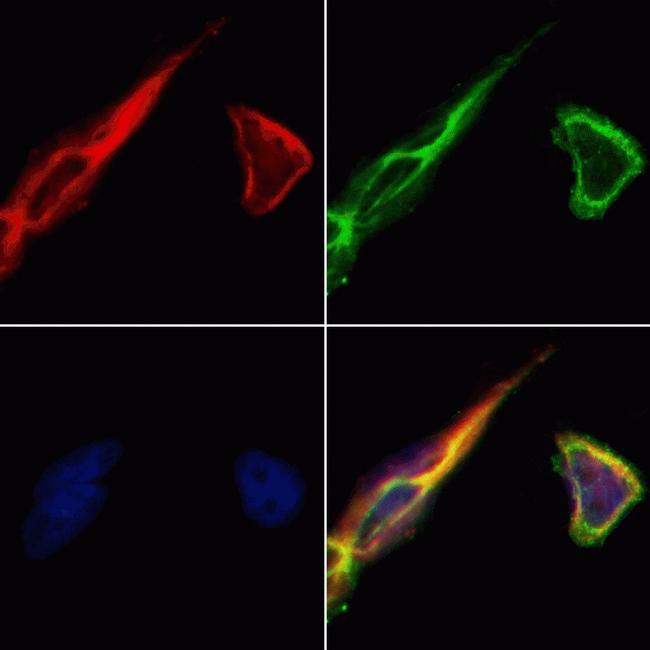 FSHR Antibody in Immunocytochemistry (ICC/IF)