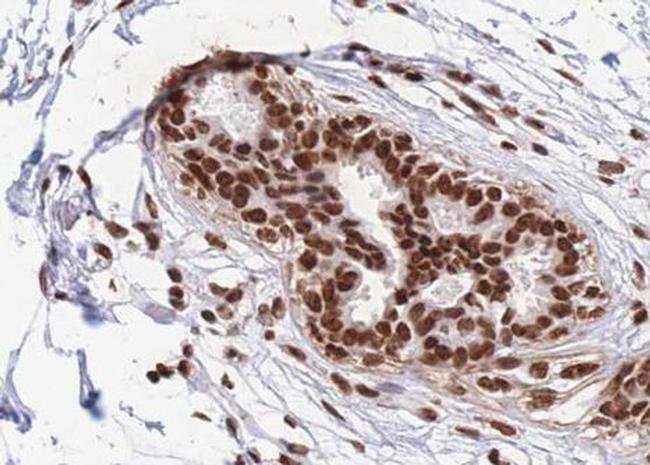 RBMX Antibody in Immunohistochemistry (Paraffin) (IHC (P))