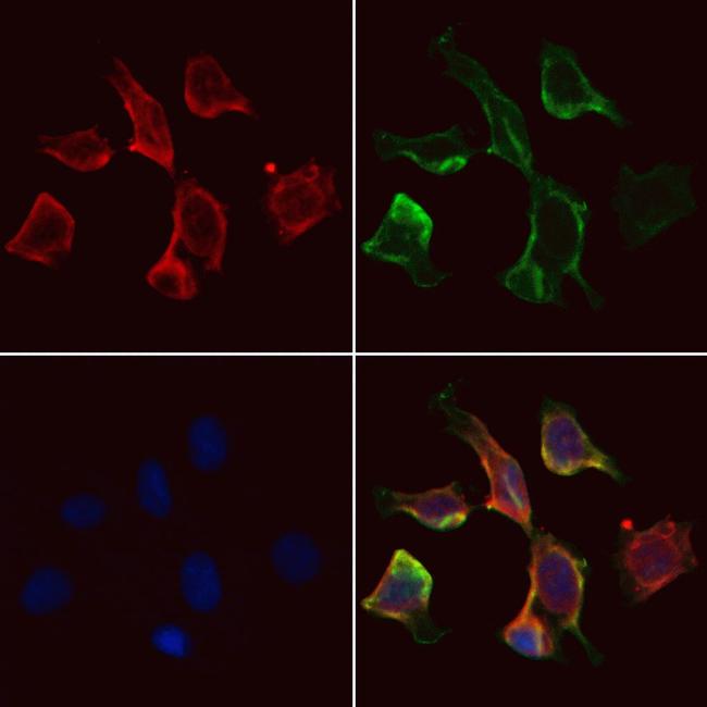 KEAP1 Antibody in Immunocytochemistry (ICC/IF)