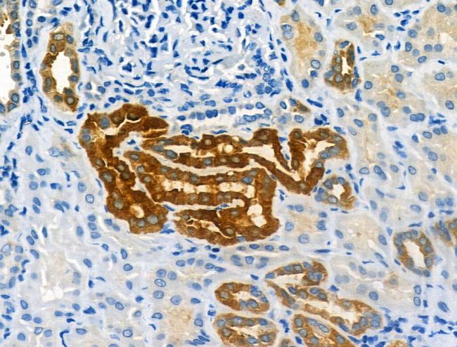 CMKLR1 Antibody in Immunohistochemistry (Paraffin) (IHC (P))