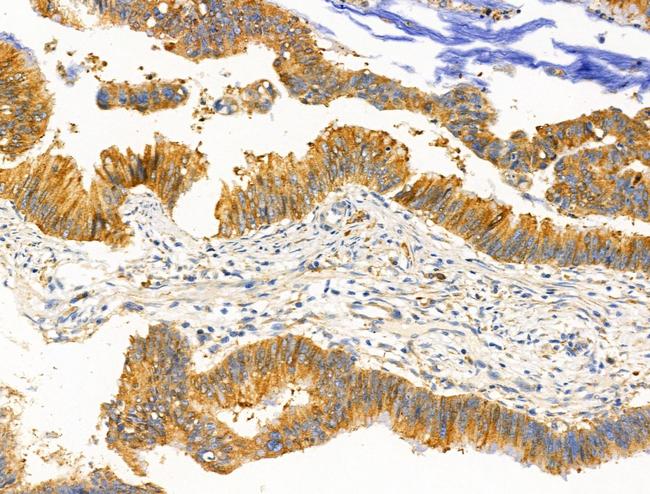 KChIP3 Antibody in Immunohistochemistry (Paraffin) (IHC (P))