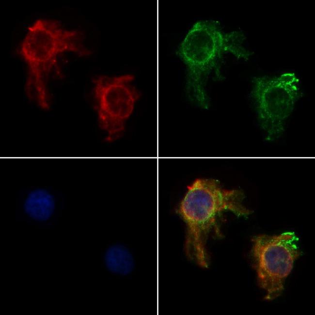 ACTA1 Antibody in Immunocytochemistry (ICC/IF)