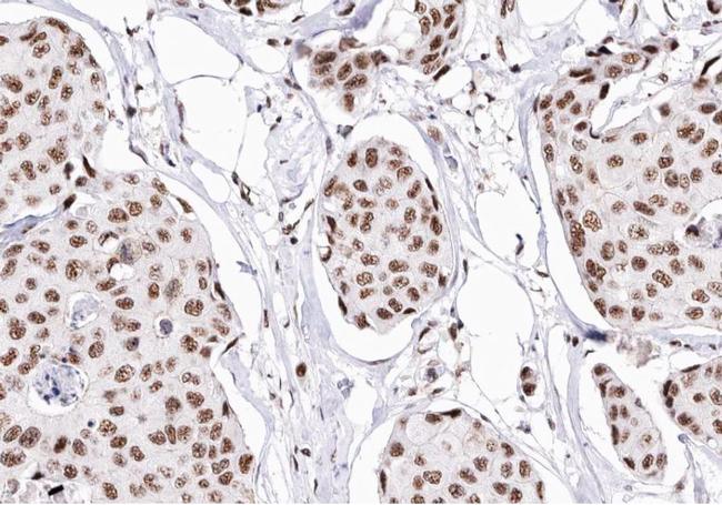 CDKN2C Antibody in Immunohistochemistry (Paraffin) (IHC (P))