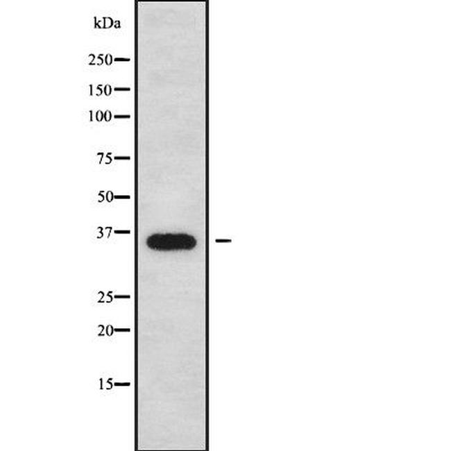 Phospho-Annexin A2 (Ser26) Antibody in Western Blot (WB)