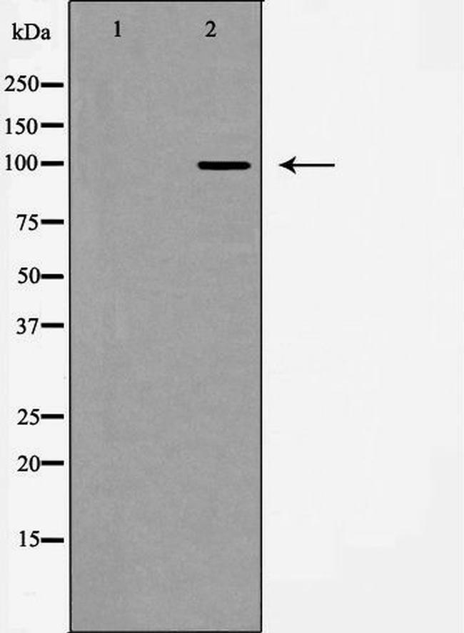 mGluR2/mGluR3 Antibody in Western Blot (WB)