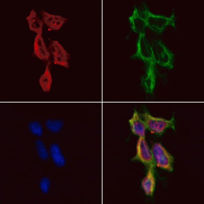 HDAC10 Antibody in Immunocytochemistry (ICC/IF)