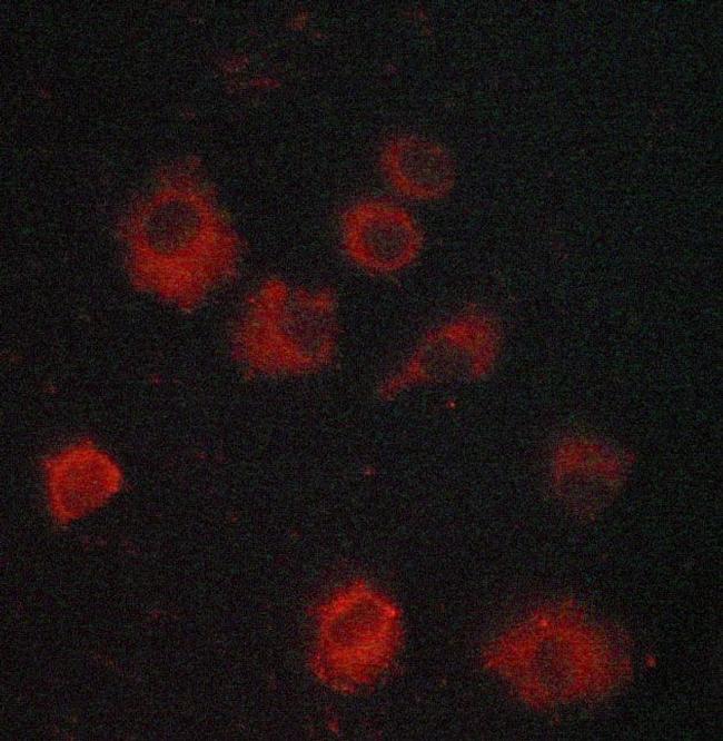 IkB epsilon Antibody in Immunocytochemistry (ICC/IF)