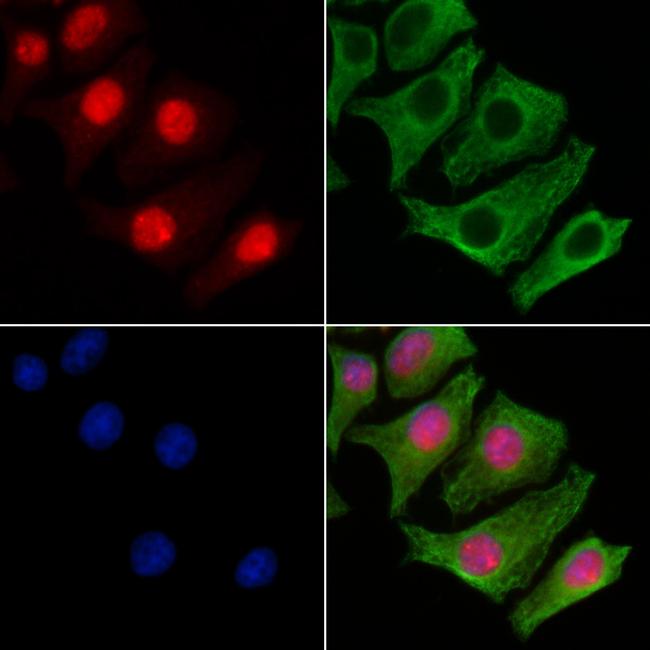 PDPK1 Antibody in Immunocytochemistry (ICC/IF)