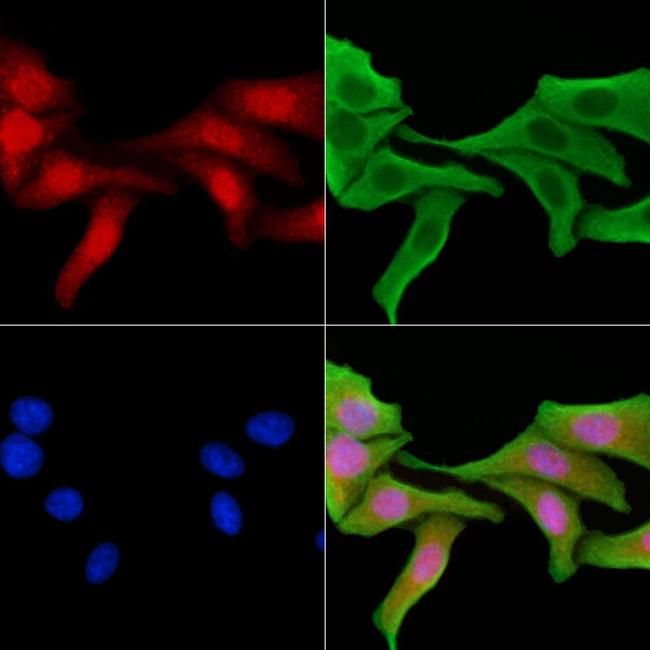 MiTF Antibody in Immunocytochemistry (ICC/IF)