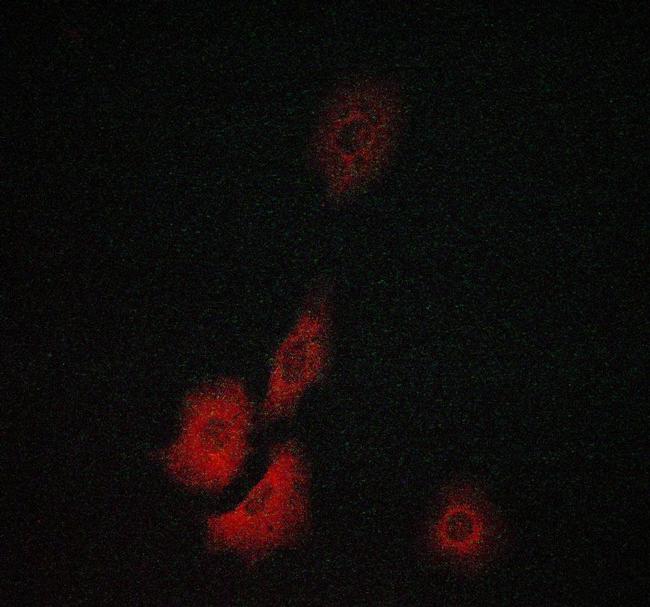 TK1 Antibody in Immunocytochemistry (ICC/IF)