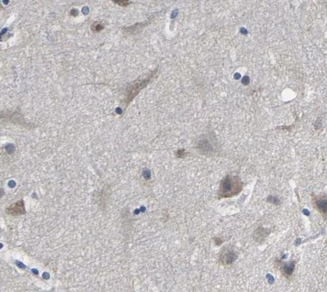 hnRNP C1/C2 Antibody in Immunohistochemistry (Paraffin) (IHC (P))