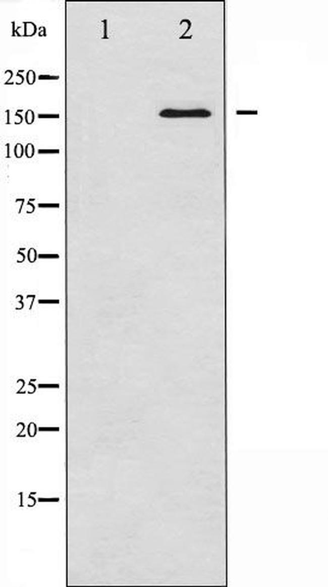 Bcr Antibody in Western Blot (WB)