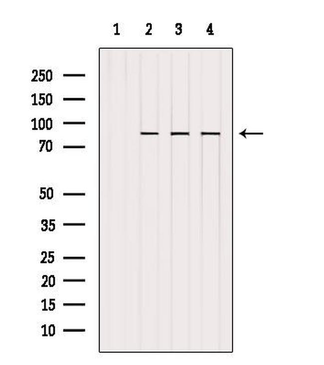 GYS1 Antibody in Western Blot (WB)