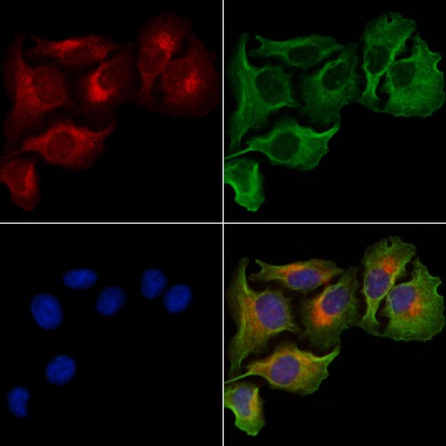 PLCG1 Antibody in Immunocytochemistry (ICC/IF)